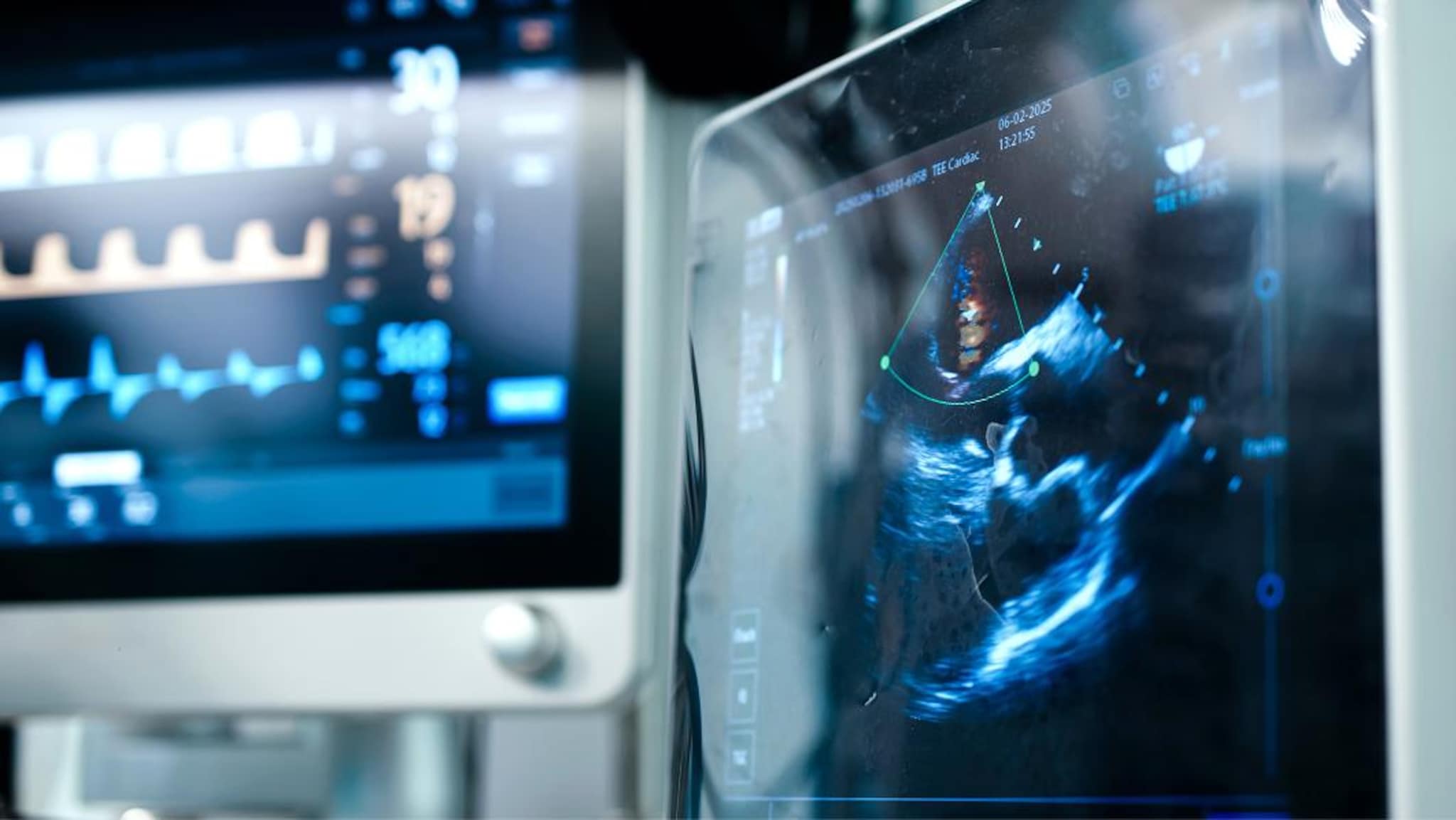 Primo piano dello schermo di un ecografo che mostra un’immagine ecografica del cuore, con un monitor di parametri cardiaci sullo sfondo.